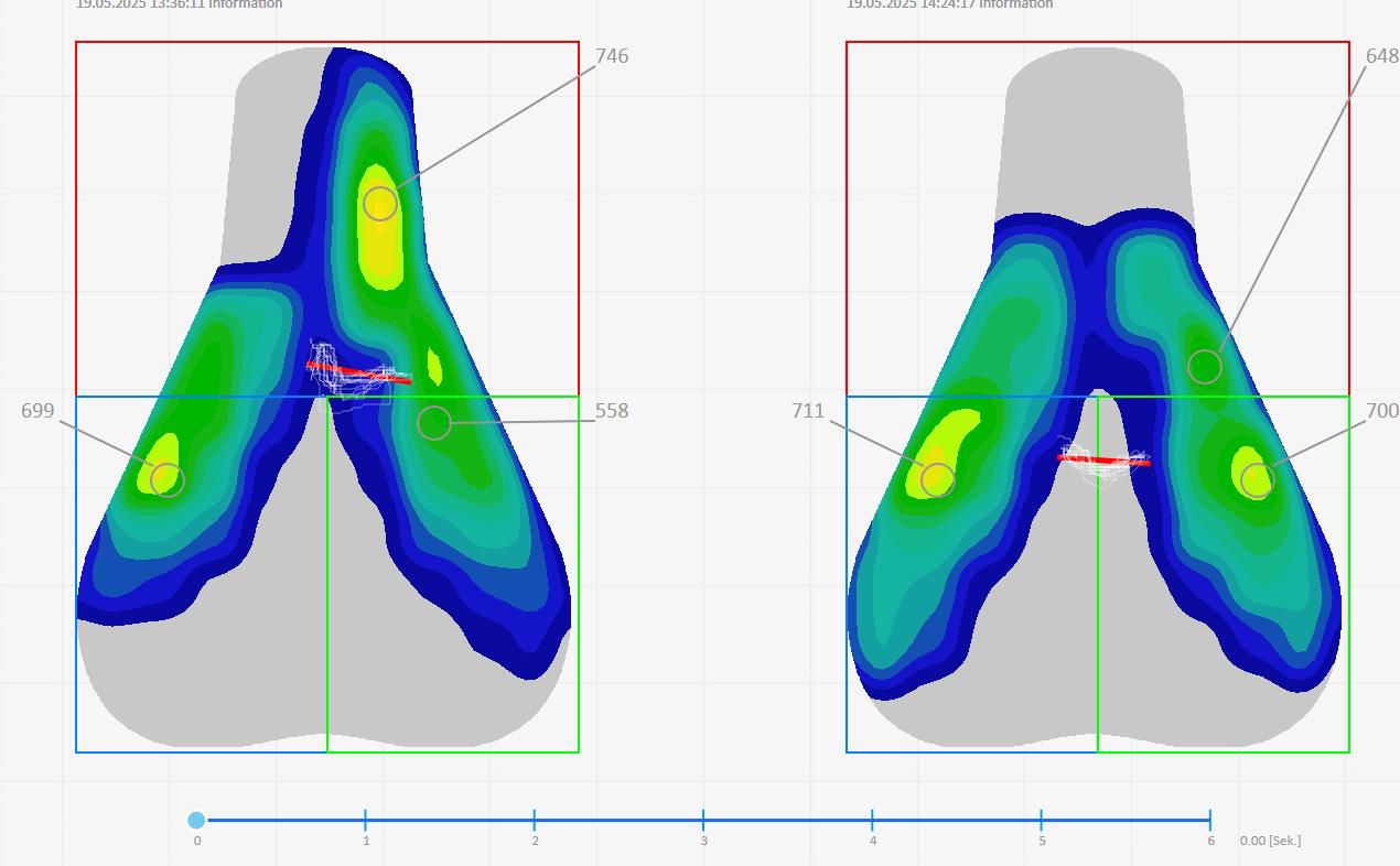 Saddle pressure mapping analysis